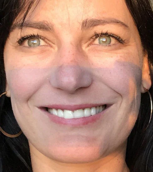 Depois do tratamento